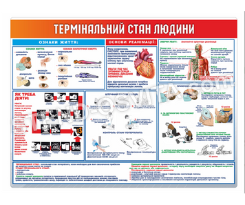 Стенд "Термінальний стан людини"